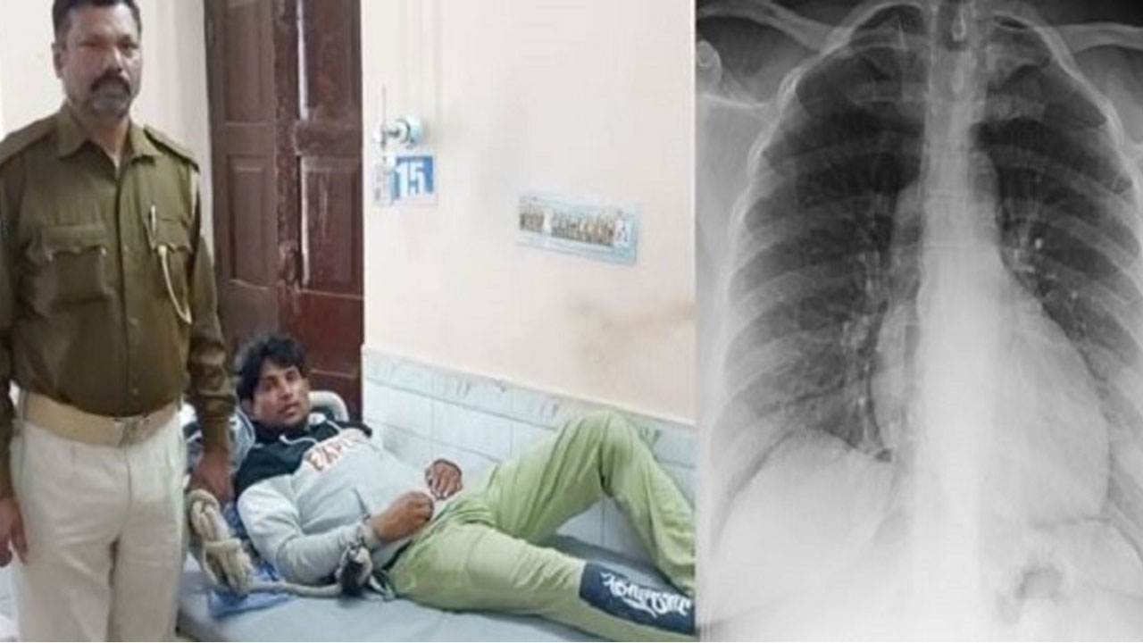 ఖైదీ క‌డుపులో నొప్పి.. స్కానింగ్‌లో మొబైల్ ద‌ర్శ‌నం