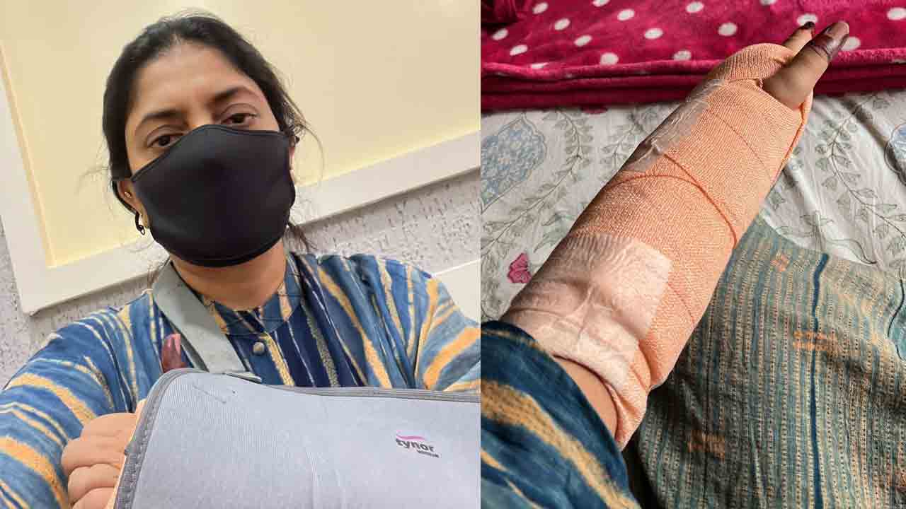 Sudha Kongara | ఆకాశం నీ హద్దురా దర్శకురాలికి తీవ్ర గాయాలు.. బాధగా ఉందంటూ పోస్ట్‌..!