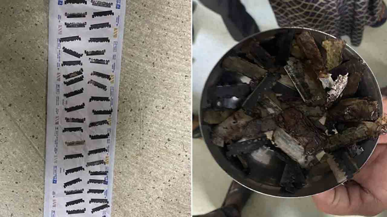 Razor Blades | 56 బ్లేడ్‌లు మింగిన వ్యక్తి.. సర్జరీ ద్వారా తొలగించిన వైద్యులు