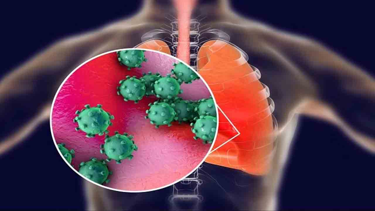 H3N2 Influenza Virus | హాంకాంగ్‌ ఫ్లూ డేంజర్‌ బెల్స్‌.. H3N2 వైరస్‌ బారినపడి ఇద్దరు మృతి