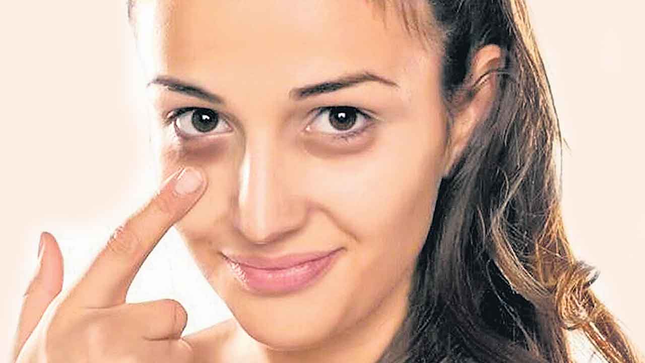 Under Eye Bags |  కళ్ల కింద క్యారీ బ్యాగులా? ఇలా మీ నయనాలను అందంగా మార్చుకోండి