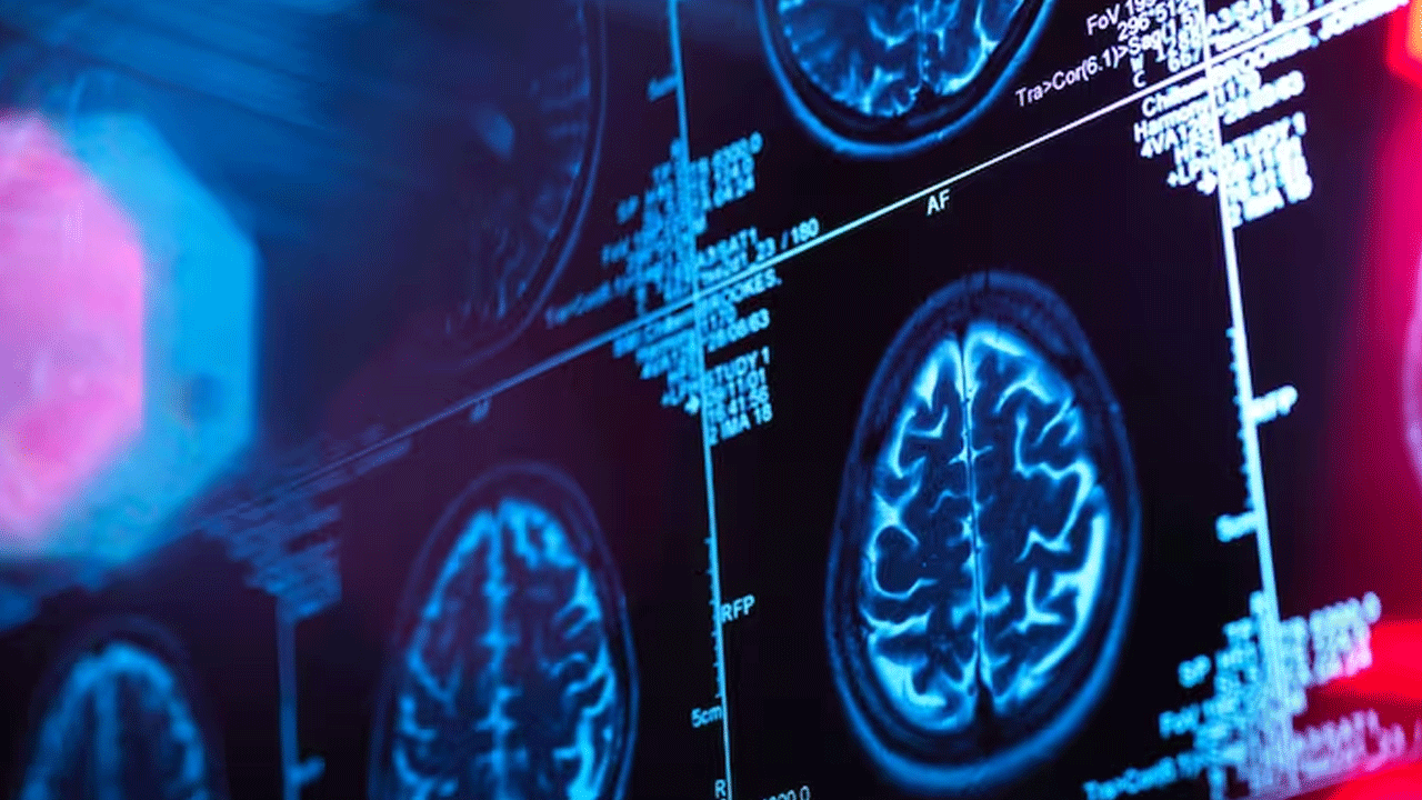 Stroke | స్ట్రోక్ కార‌ణంగా భార‌త్‌లో ప్ర‌తి నాలుగు నిమిషాల‌కు ఒక‌రు మృతి