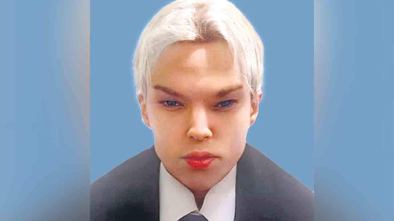 Plastic surgery |  ప్రాణం తీసిన ప్లాస్టిక్‌ సర్జరీ.. అభిమాన సింగర్‌లా కనిపించాలనుకుని ప్రాణాలు పోగొట్టుకున్నాడు..