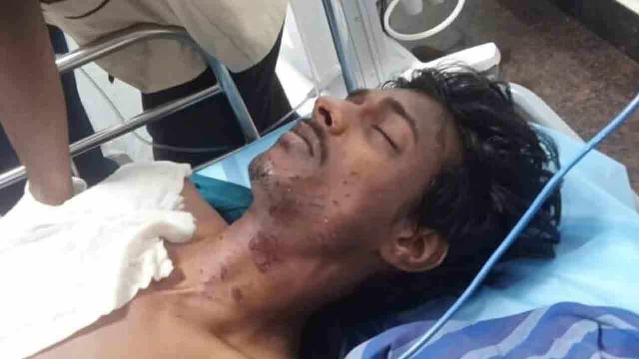 బాంబుల తయారీలో ఆరెస్సెస్‌ కార్యకర్త