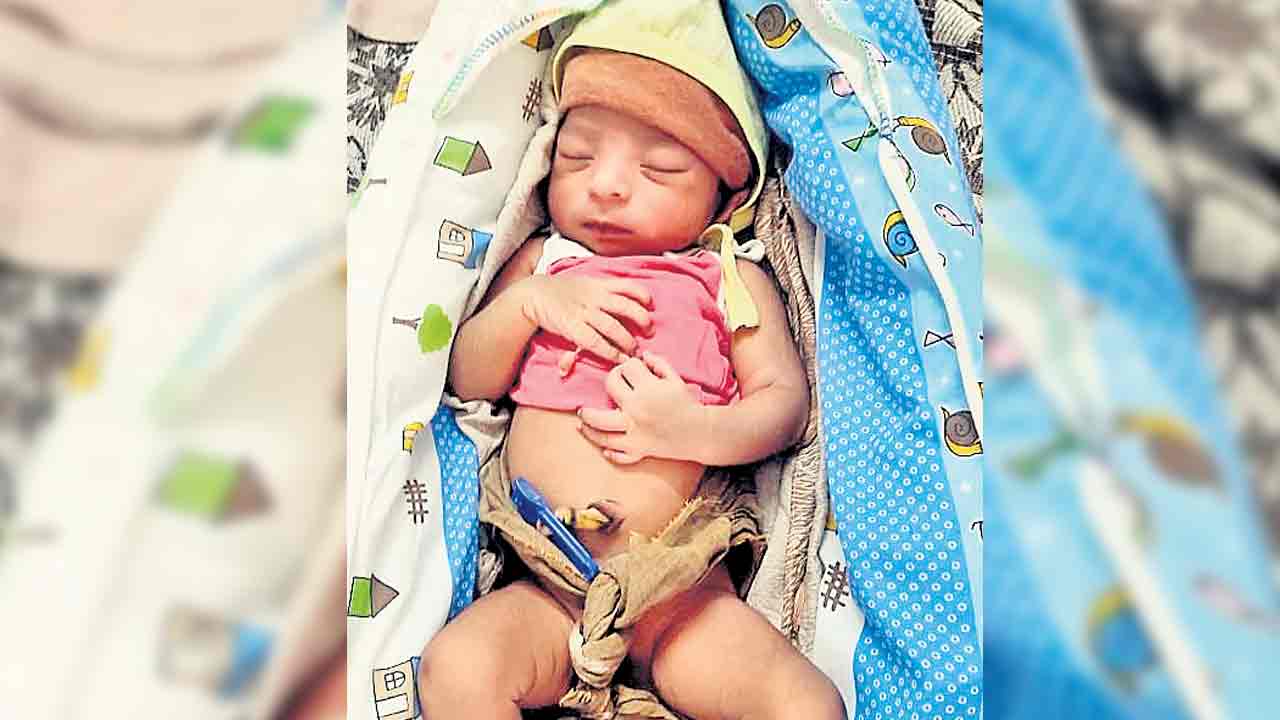 Viral News | 24 వేళ్లతో శిశువు జననం.. కోరుట్ల ప్రభుత్వ దవాఖానలో అరుదైన ఘటన