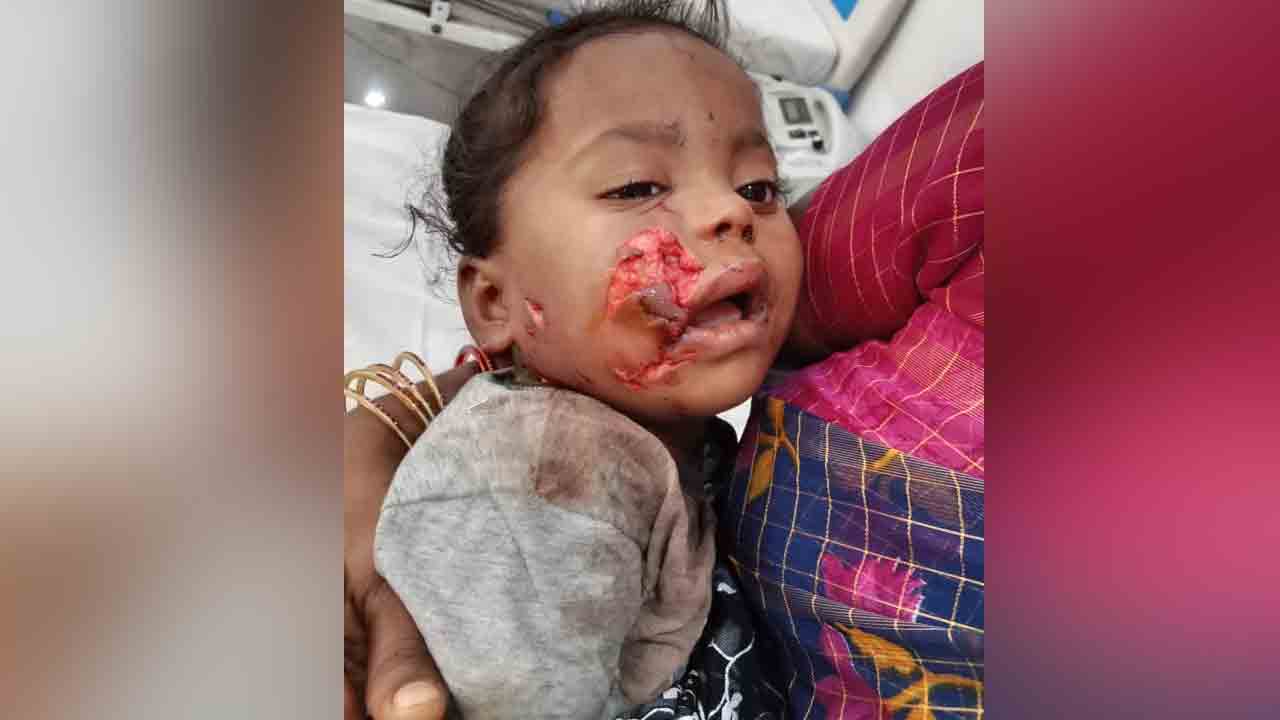 వీధి కుక్కల స్వైరవిహారం