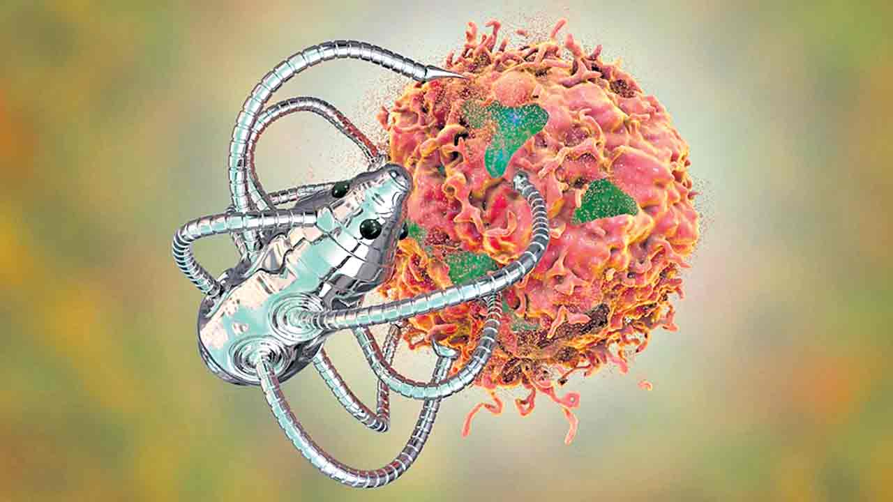 రొమ్ము క్యాన్సర్‌కు బ్యాటరీ ఇంప్లాంట్‌