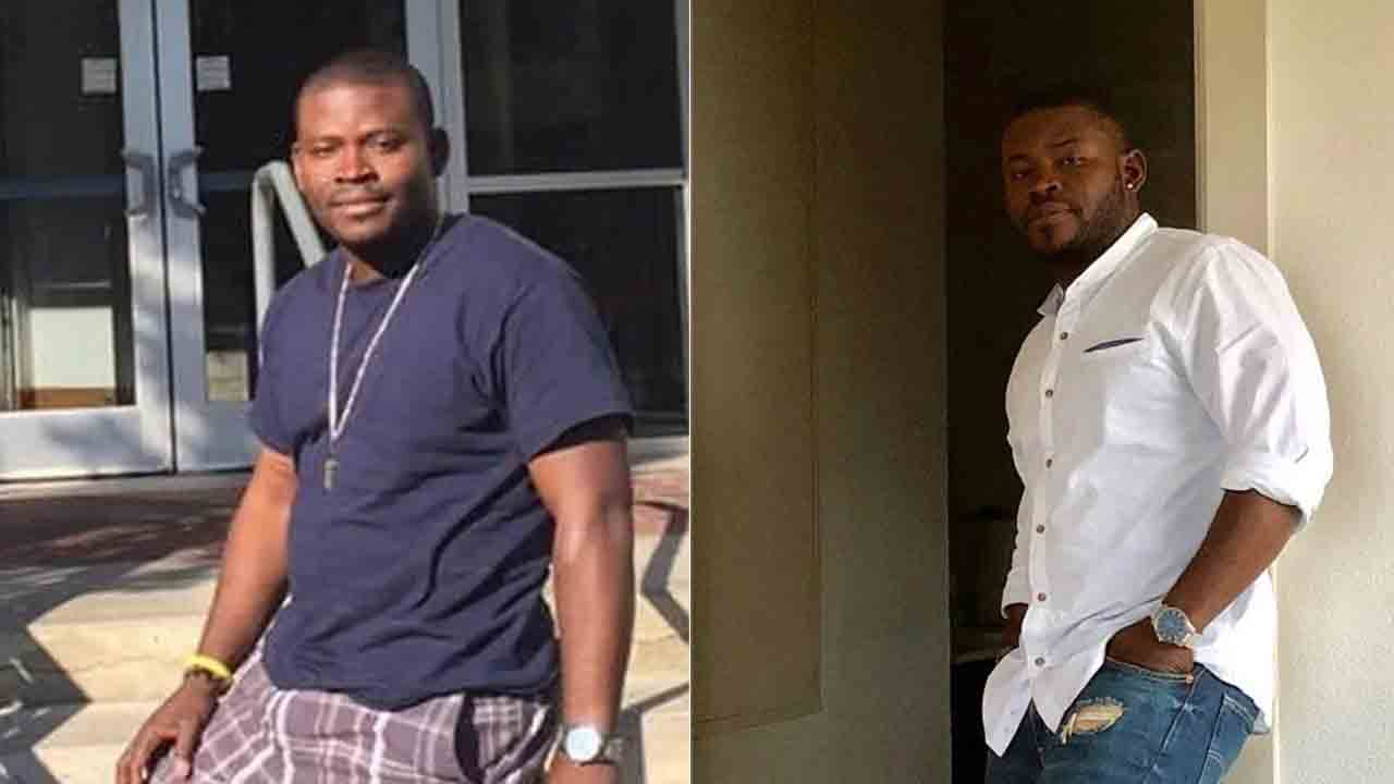 Lengthening surgery | అమ్మాయిలు డేటింగ్‌కు రావట్లేదని.. రూ.కోటికి పైనే ఖర్చు చేశాడు