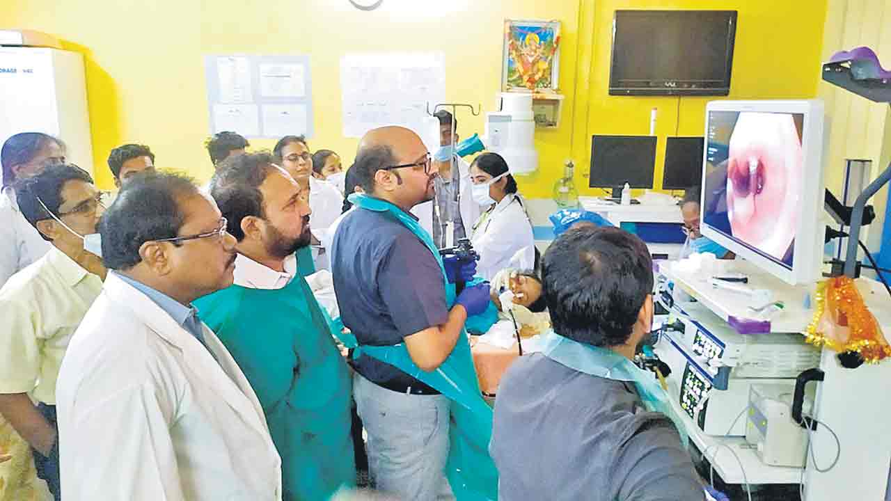 గాంధీలో 190 స్కోప్స్‌తో అన్నవాహికకు శస్త్రచికిత్స