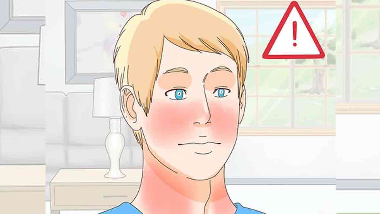 Liquor allergy |  మందు తాగితే రంగు పడుద్ది.. మద్యం వల్ల లిక్కర్‌ అలర్జీ