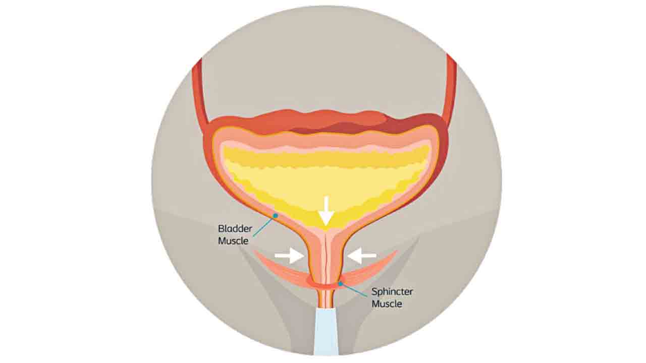 మహిళల్లో యూరినరీ ఇన్‌ఫెక్షన్లు