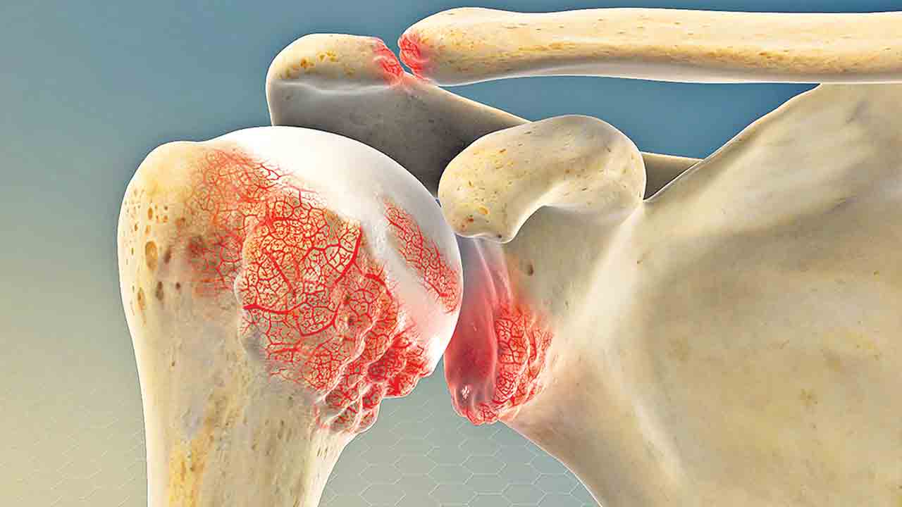 Bones