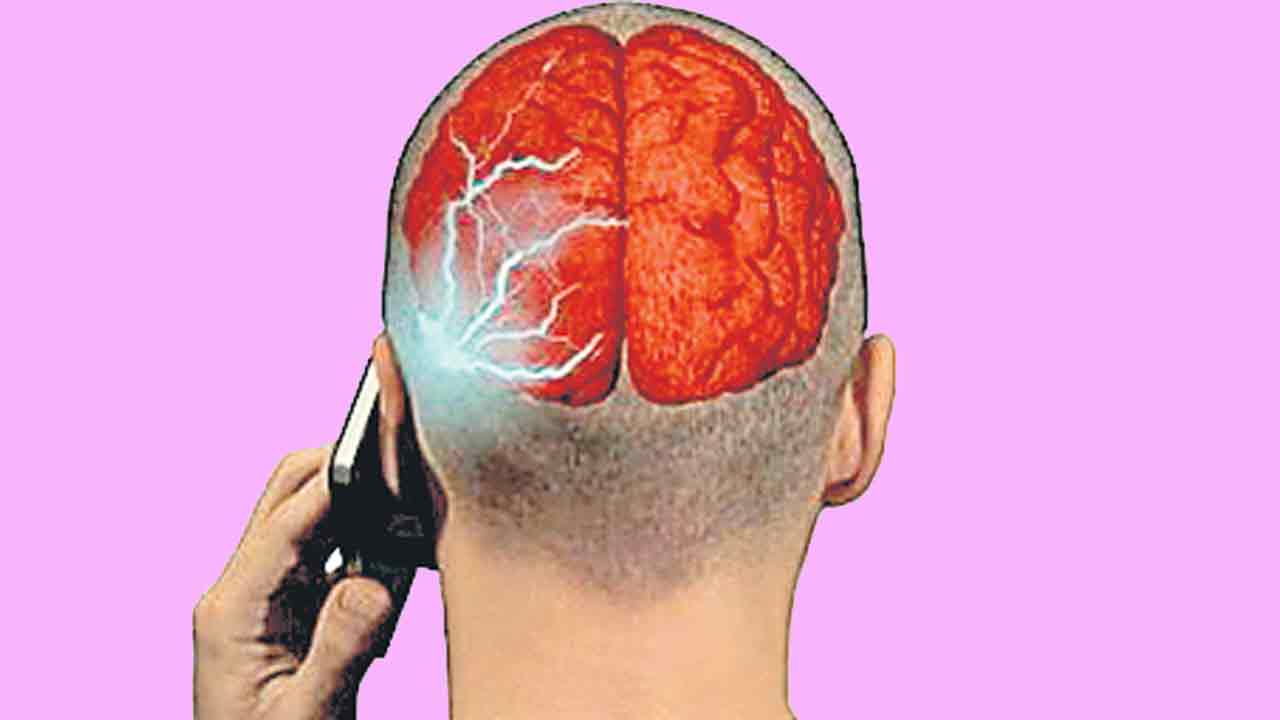 Brain tumor |  రేడియేషన్‌తో బ్రెయిన్‌ ట్యూమర్‌ ముప్పు.. పిల్లల్లో బయటపడుతున్న వ్యాధి