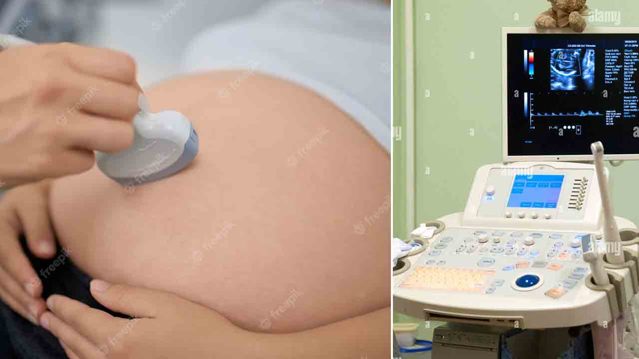 పురిట్లోనే చంపేస్తున్నారు!