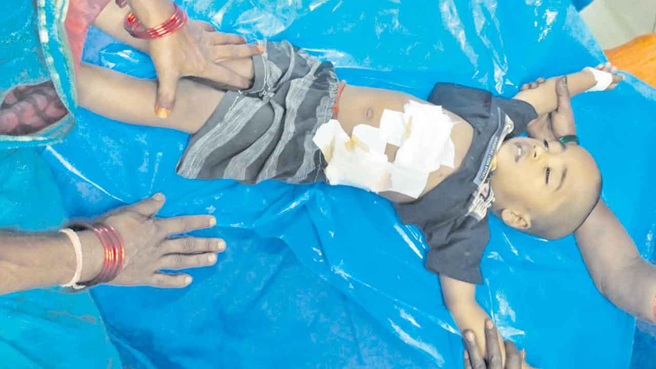 కుక్కల దాడిలో బాలుడికి తీవ్ర గాయాలు