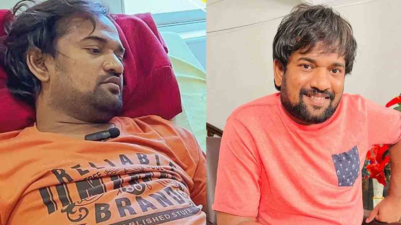 Punch Prasad | మరింత విషమంగా పంచ్ ప్రసాద్ ఆరోగ్యం.. ఆర్థిక సహయం కోసం ఎదురు చూపులు