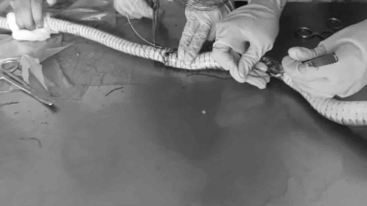 Viral Video | ఆపరేషన్‌ చేసి పామును బతికించిన వైద్యులు.. కరీంనగర్‌లో మానవత్వం చాటుకున్న జంతు ప్రేమికులు