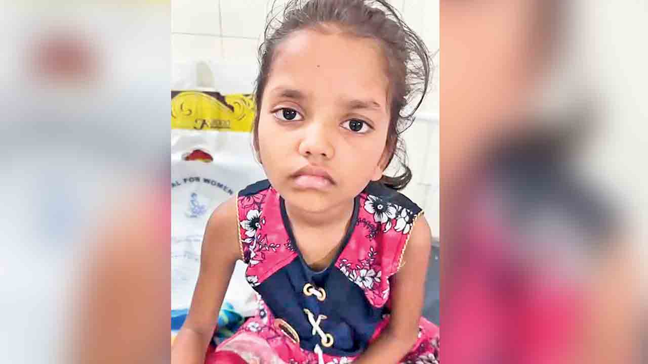 నిరుపేద బాలికకు అరుదైన శస్త్రచికిత్స