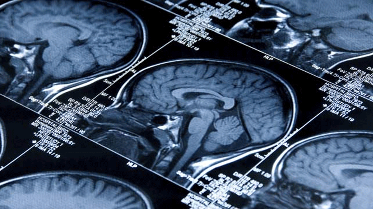 Rare Brain Infection | కేరళలో బయటపడిన అరుదైన బ్రెయిన్ ఇన్ఫెక్షన్ కేసు.. లక్షణాలివే!