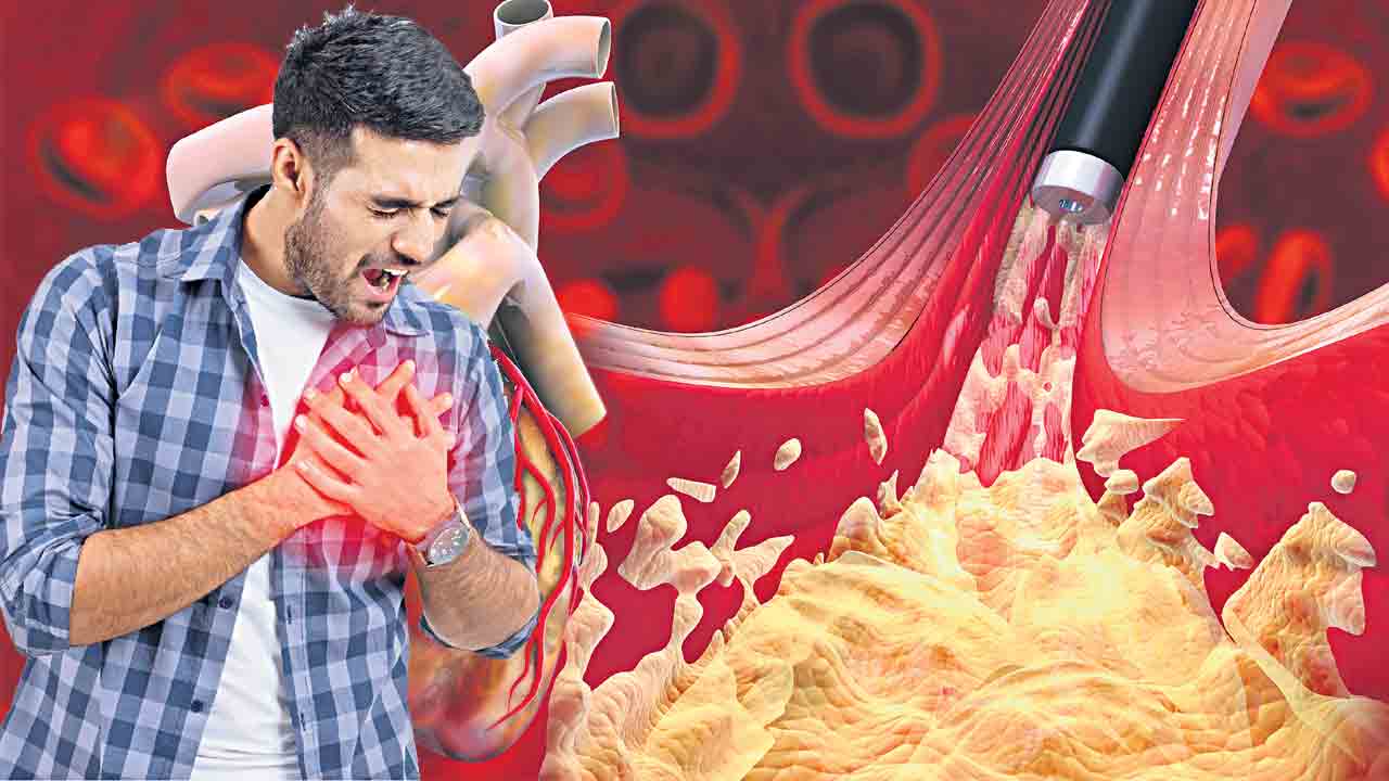 నలభై నిండకుండానే ఆగిపోతున్న గుండెలు.. ఎందుకీపరిస్థితి?.. డాక్టర్లేమంటున్నారు?