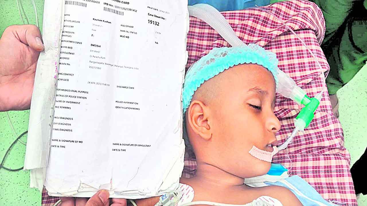 కాక్లియర్‌ ఇంప్లాంట్‌ సర్జరీలు షురూ