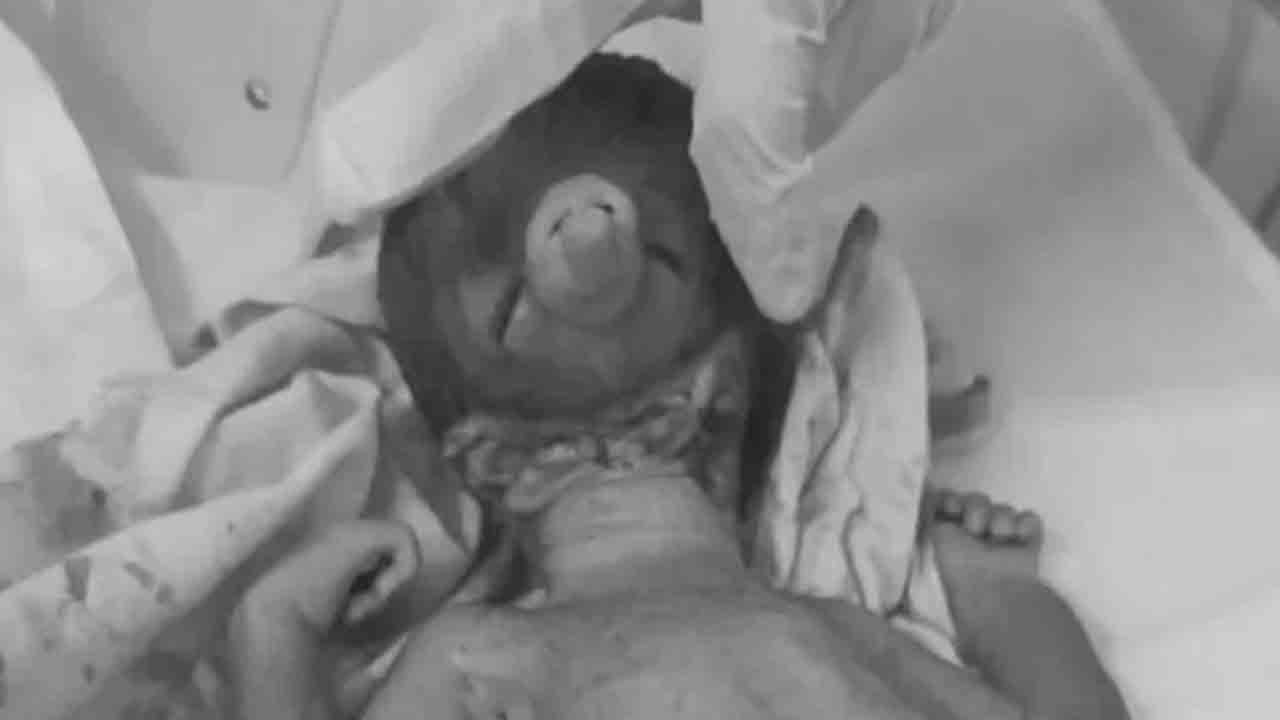 Baby resembling God Ganesha | మూతికి తొండంతో జన్మించిన శిశువు.. గణేషుని పోలిక అంటున్న జనం