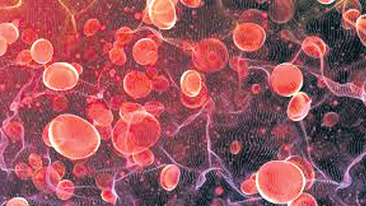 జాన్సన్‌ అండ్‌ జాన్సన్‌ బ్లడ్‌ క్యాన్సర్‌ థెరపీకి ఆమోదం