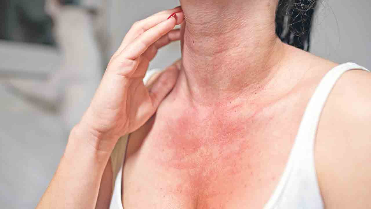 ఆదమరిస్తే అలర్జీ!