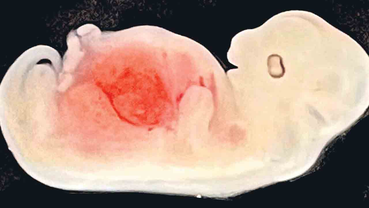 Pig Embryo |  పంది పిండంలో మానవ కిడ్నీ అభివృద్ధి.. వైద్య చరిత్రలో మరో అద్భుతం