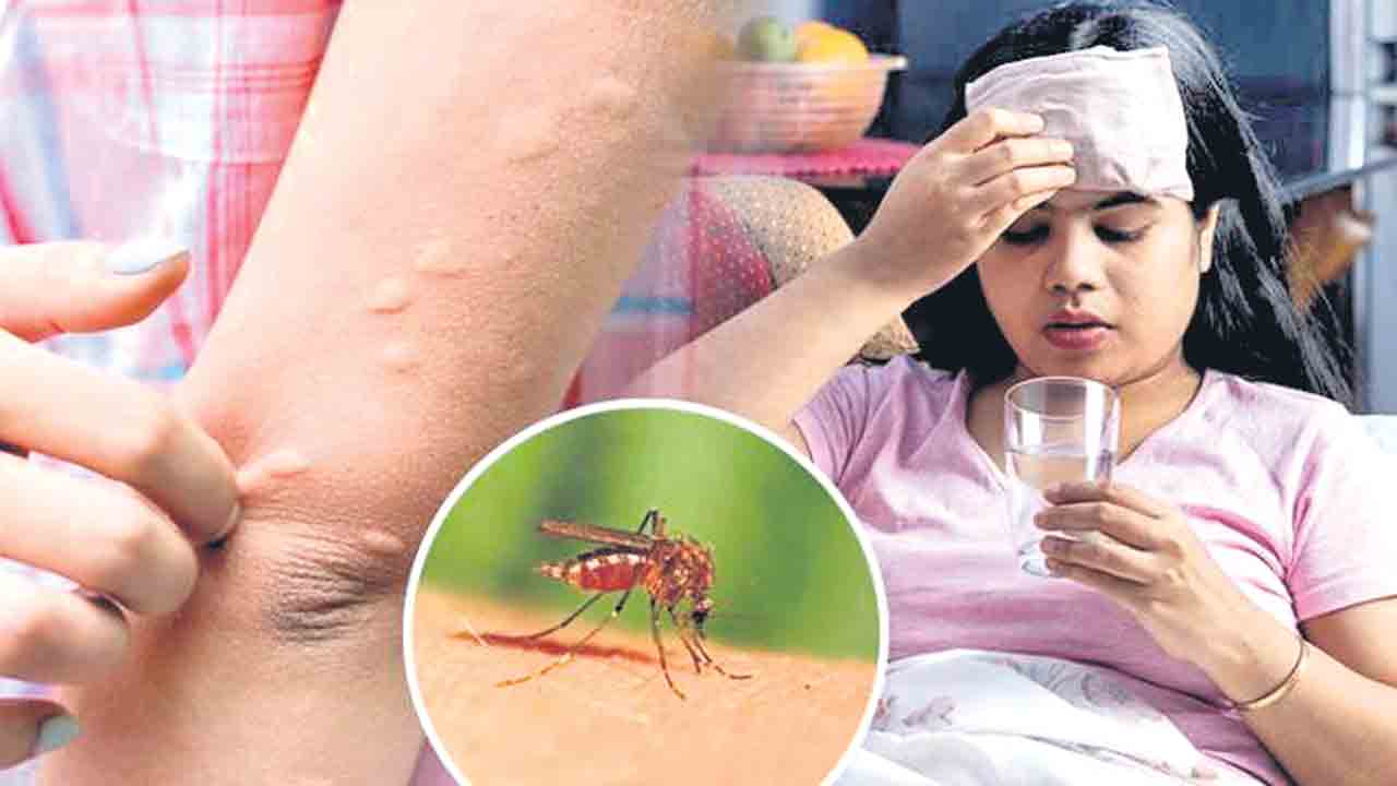 డెంగ్యూతో తస్మాత్‌ జాగ్రత్త