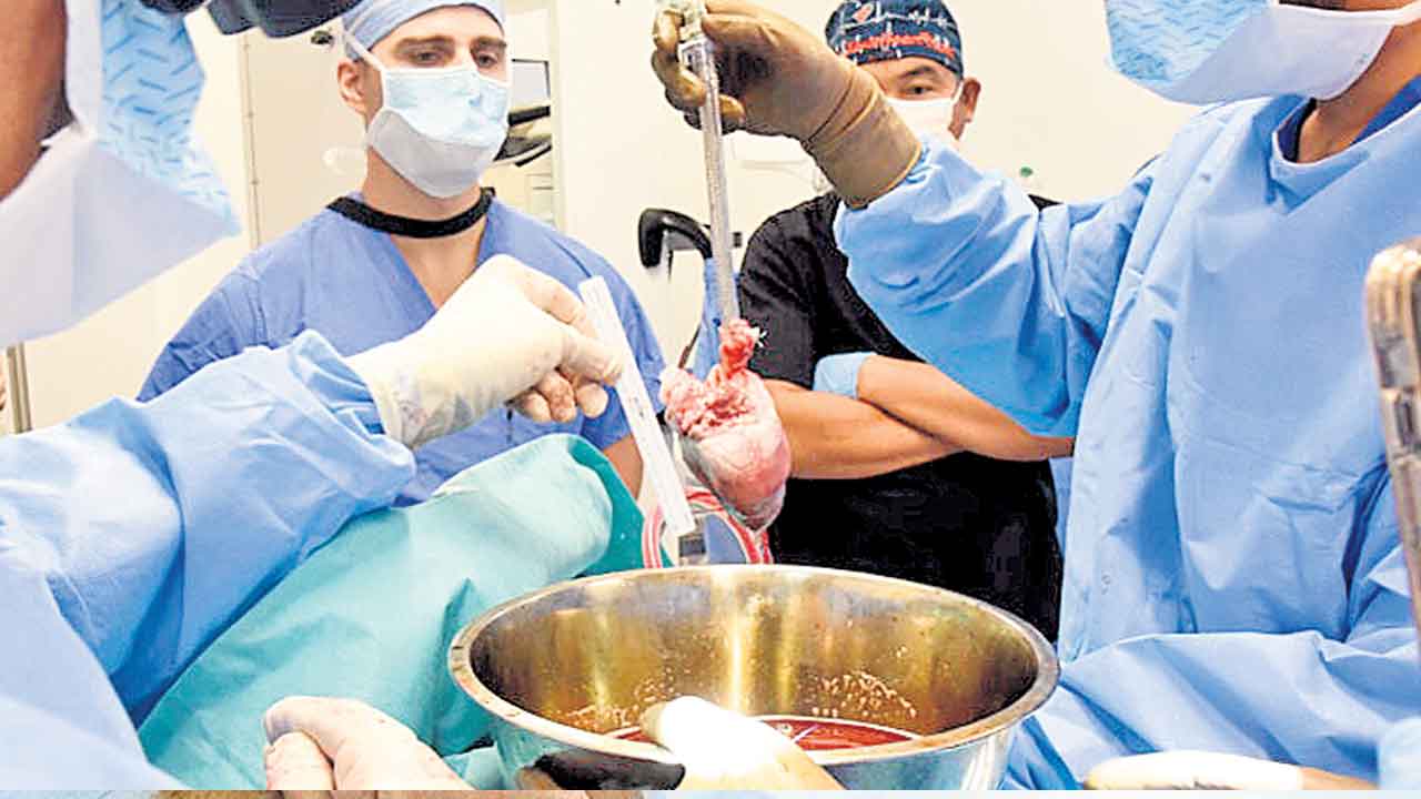 మనిషికి పంది గుండె