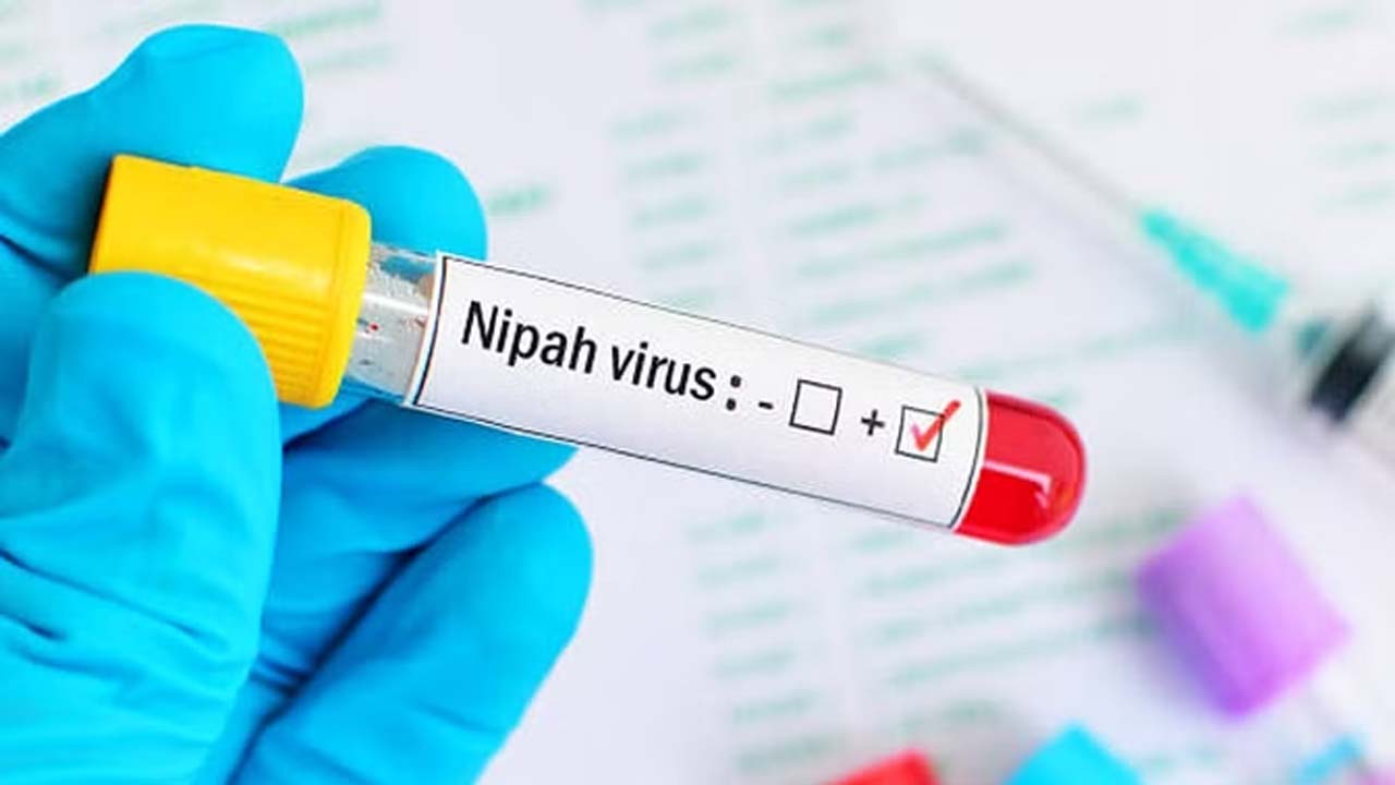 Nipah Virus 02