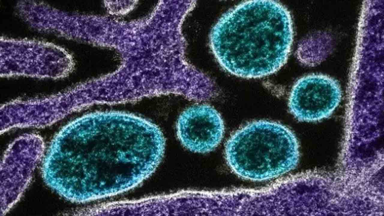 Nipah Virus | నిఫా వైరస్ కొవిడ్‌ కంటే ప్రమాదకరం.. 40-70 శాతం మరణాలకు అవకాశం : ఐసీఎంఆర్‌ డైరెక్టర్‌ జనరల్‌