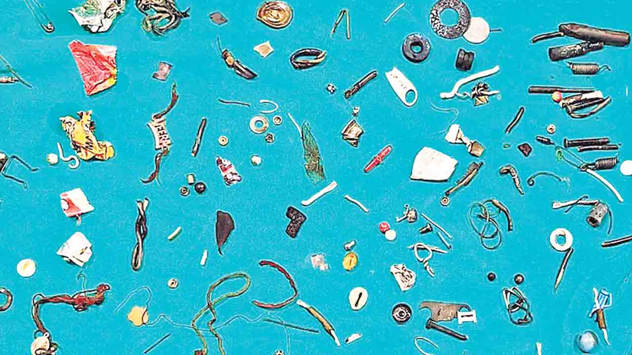 కడుపులో ఇయర్‌ ఫోన్లు, నట్లు, బోల్టులు