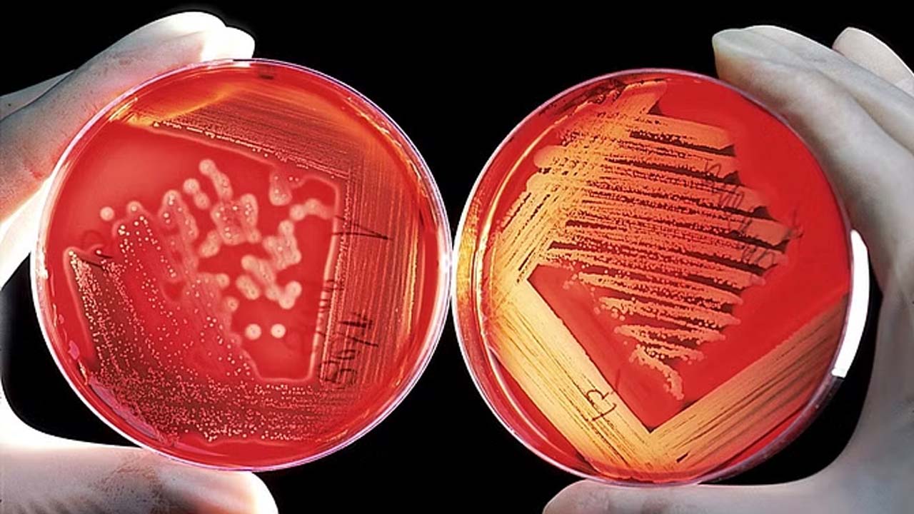 Vibrio Vulnificus | అగ్రరాజ్యాన్ని వణికిస్తున్న డెడ్‌లీ బ్యాక్టీరియా.. సీడీసీ కీలక ఆదేశాలు !