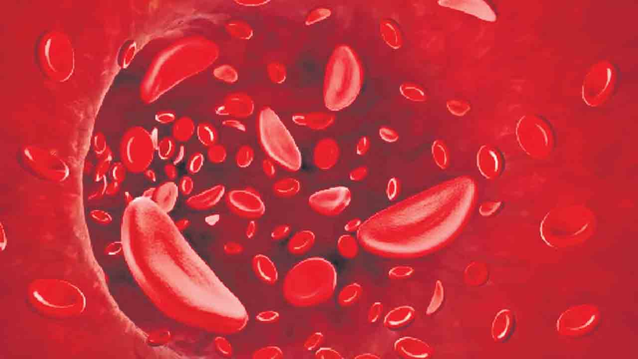 Anemia | యువతుల్లో రక్తహీనతకు కారణాలు ఇవే..