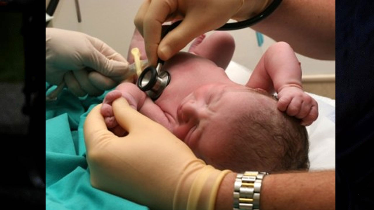 Advanced Childbirth | ముందస్తు జననాలు భారత్‌లోనే ఎక్కువ.. గ్రీస్‌, అమెరికా వంటి సంపన్న దేశాల్లోనూ