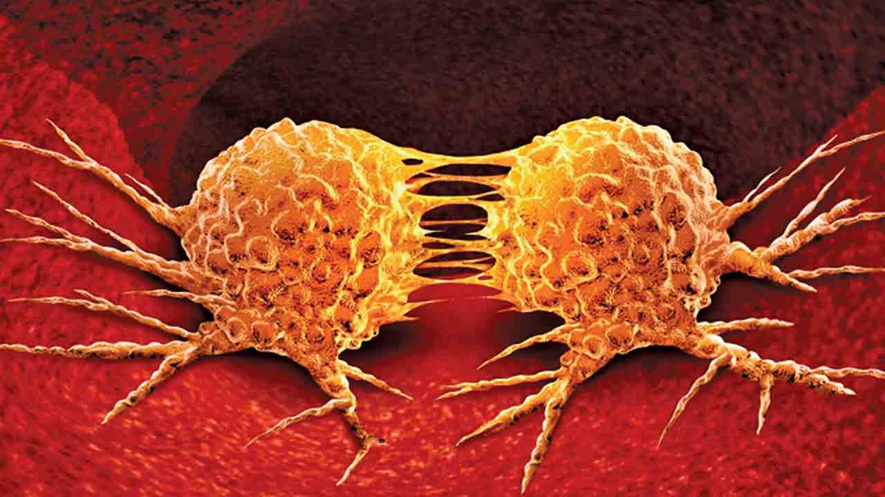 Mouth Cancer | నోటి క్యాన్సర్‌ను గుర్తించే యాప్‌.. ట్రిపుల్‌ ఐటీ విద్యార్థుల ఘనత