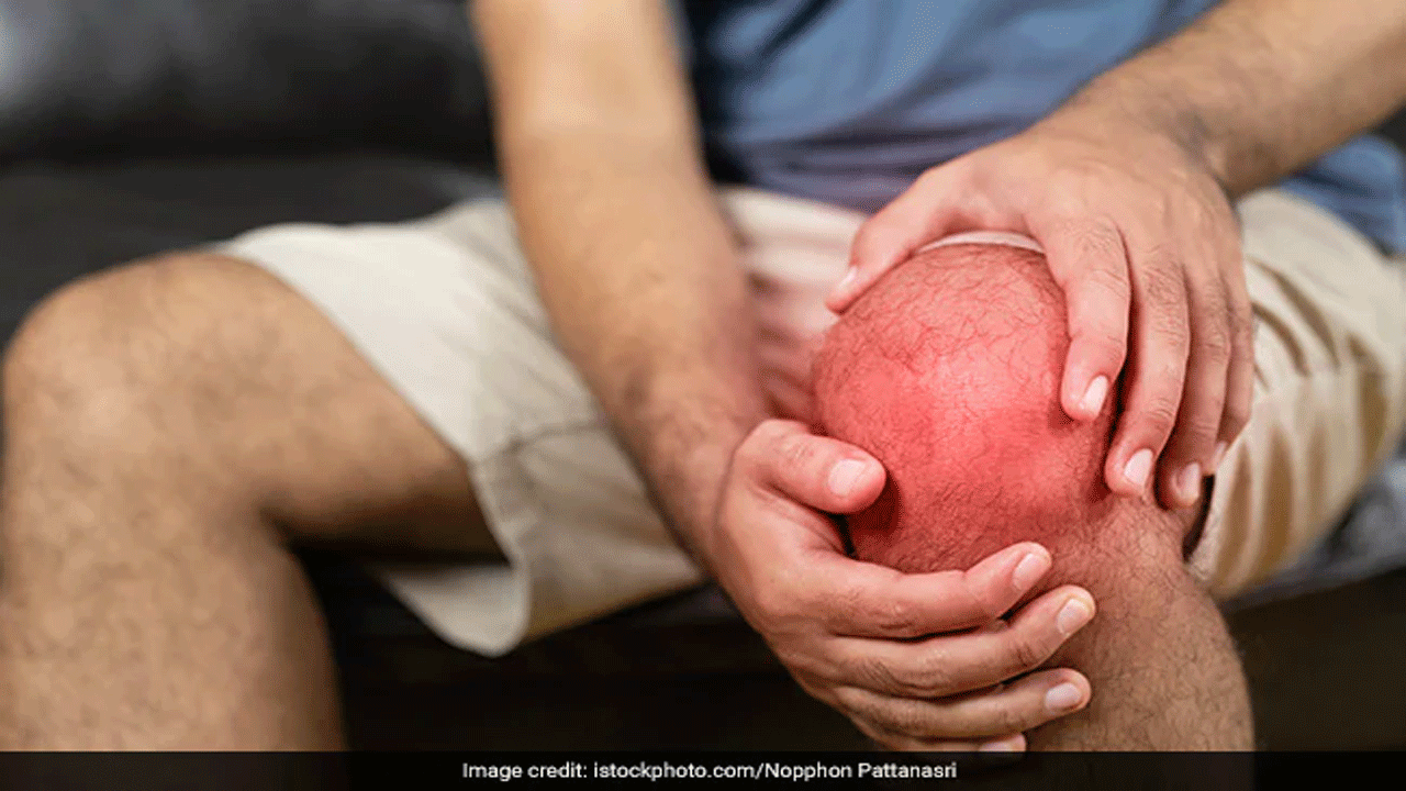 World Arthritis Day 2023 | ఈ ఔష‌ధాల‌తో అర్ధ‌రైటిస్ నుంచి ఉప‌శ‌మ‌నం..!