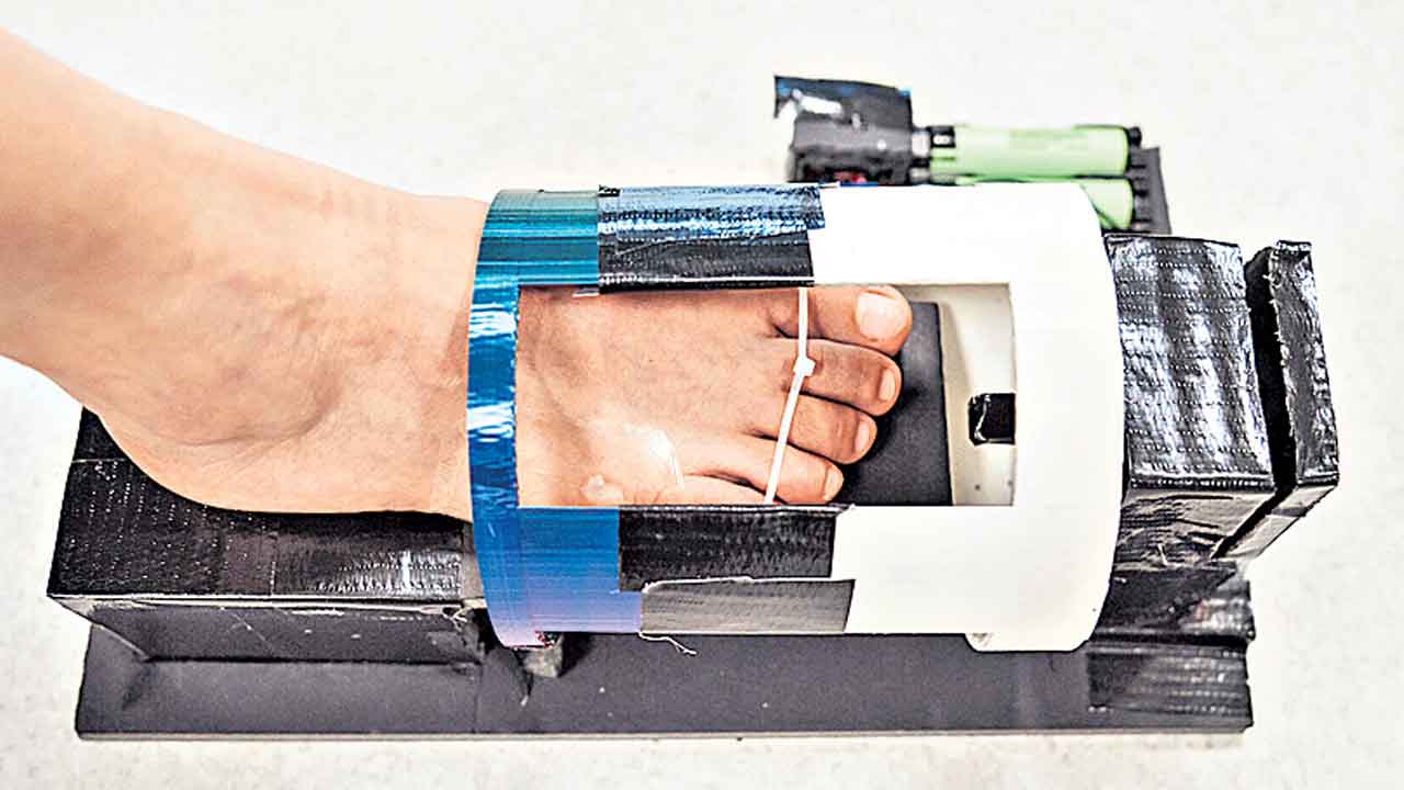 డయాబెటిక్‌ గాయాలను వేగంగా మాన్పే జెల్‌