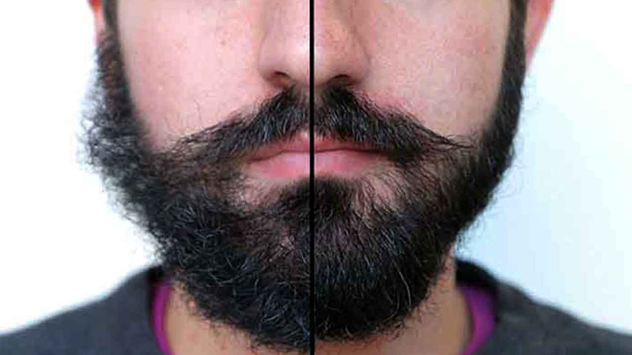 Beard Growth Tips | గడ్డం ఒత్తుగా పెరగాలా..? గడ్డం పెరగడానికి చిట్కాలు