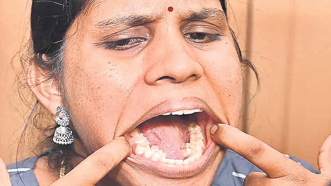 38 పళ్లతో గిన్నిస్‌ రికార్డ్‌