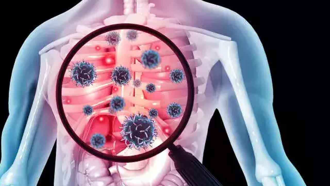 భారత్‌లోనే టీబీ కేసులు ఎక్కువ