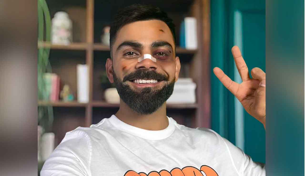 Virat Kohli | ముఖానికి గాయాలు.. ముక్కుపై బ్యాండేజ్.. అస‌లు కోహ్లీకి ఏమైంది..?