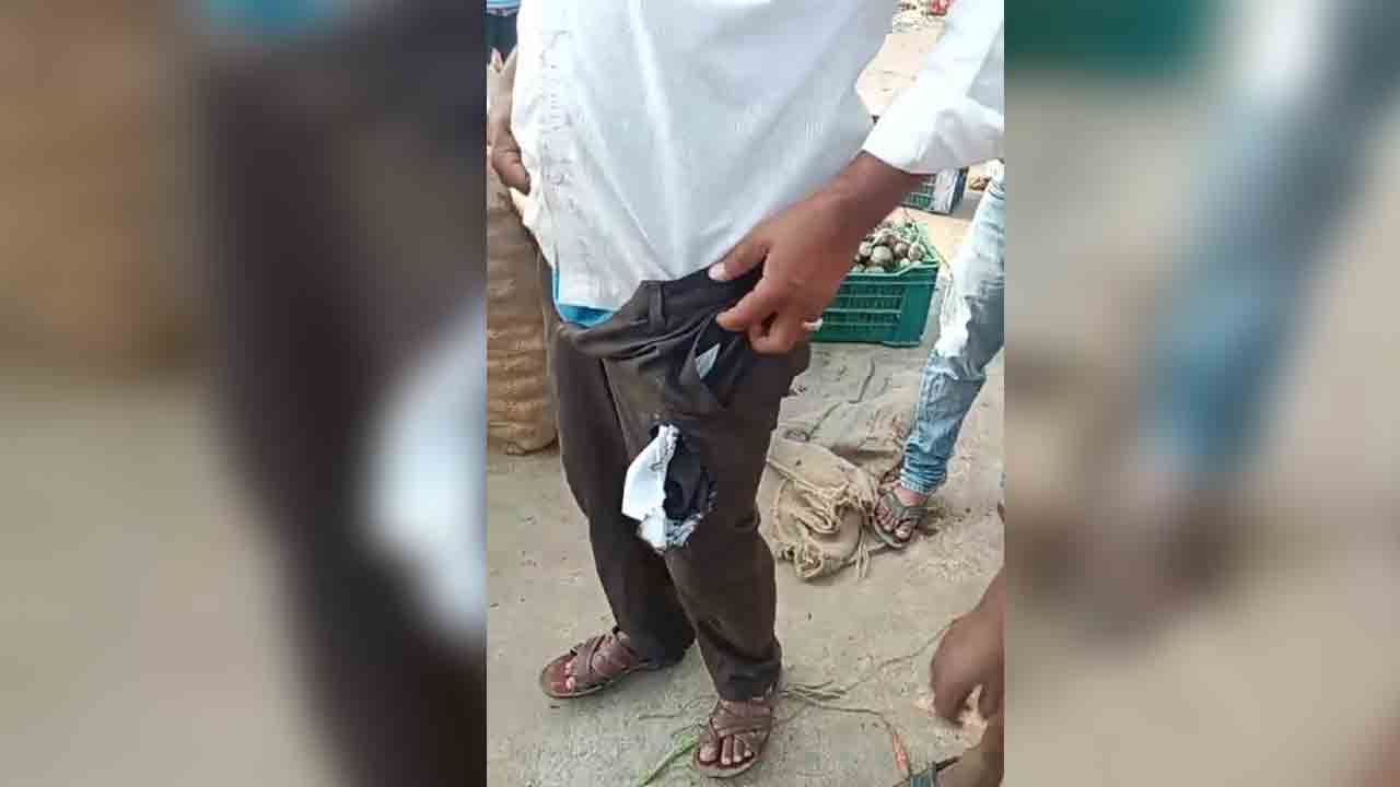 జేబులో పేలిన సెల్