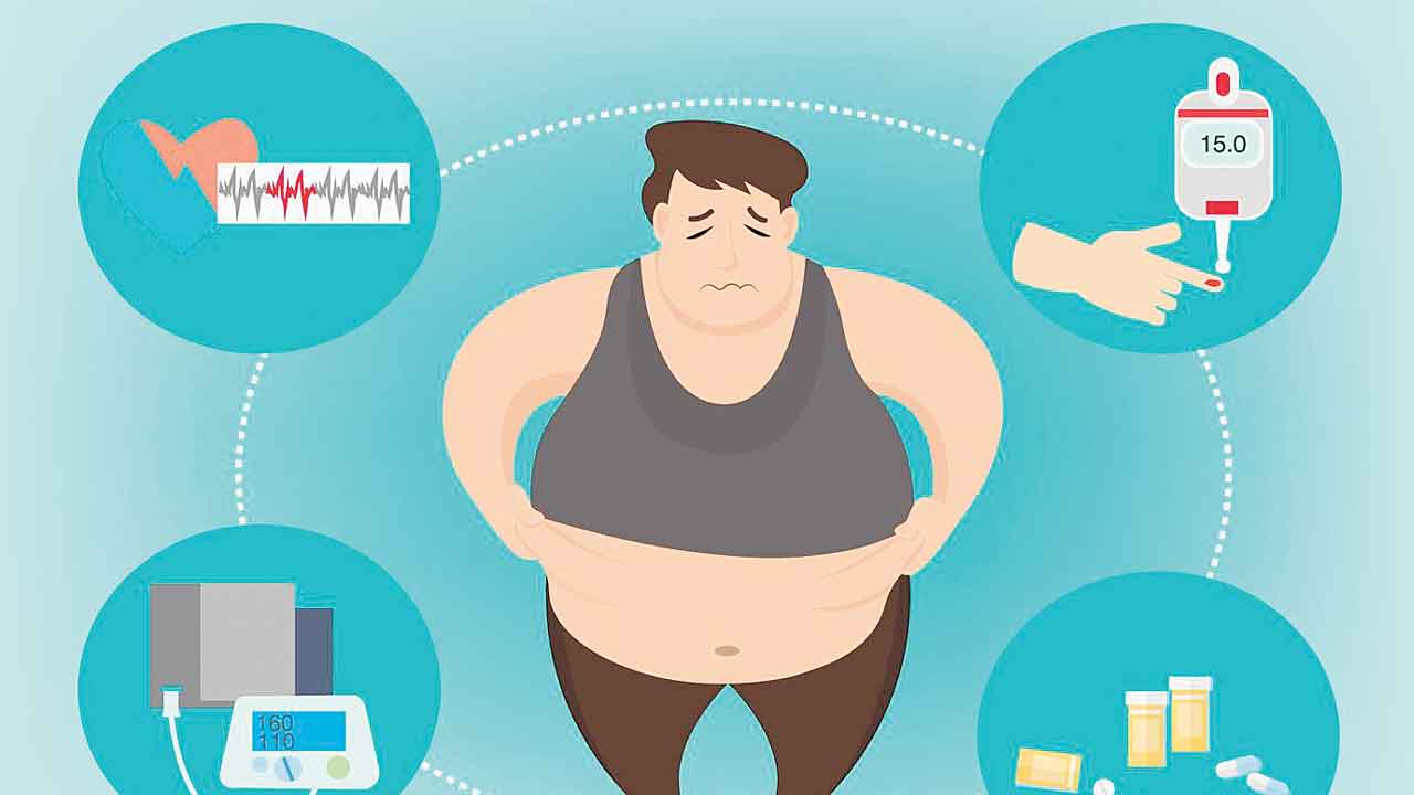 Obesity | ఆహారపు అలవాట్లు, జీవనశైలిలో మార్పులు.. తెలుగు రాష్ట్రాల్లో పెరుగుతున్న స్థూలకాయుల సంఖ్య