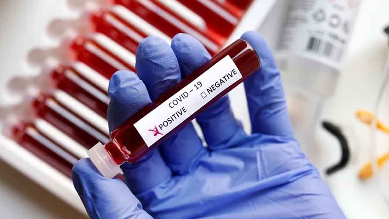 Coronavirus | 9 నెలల చిన్నారికి కరోనా పాజిటివ్‌.. నిలోఫర్‌లో చికిత్స