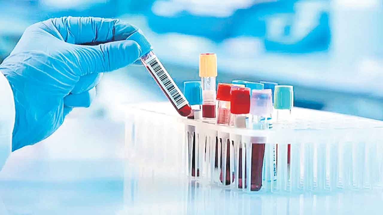Blood Test | ఒక్క రక్తపరీక్షతో అన్ని రోగాలు గుర్తించొచ్చు.. భవిష్యత్తులో వచ్చే అనారోగ్య సమస్యలు కూడా!