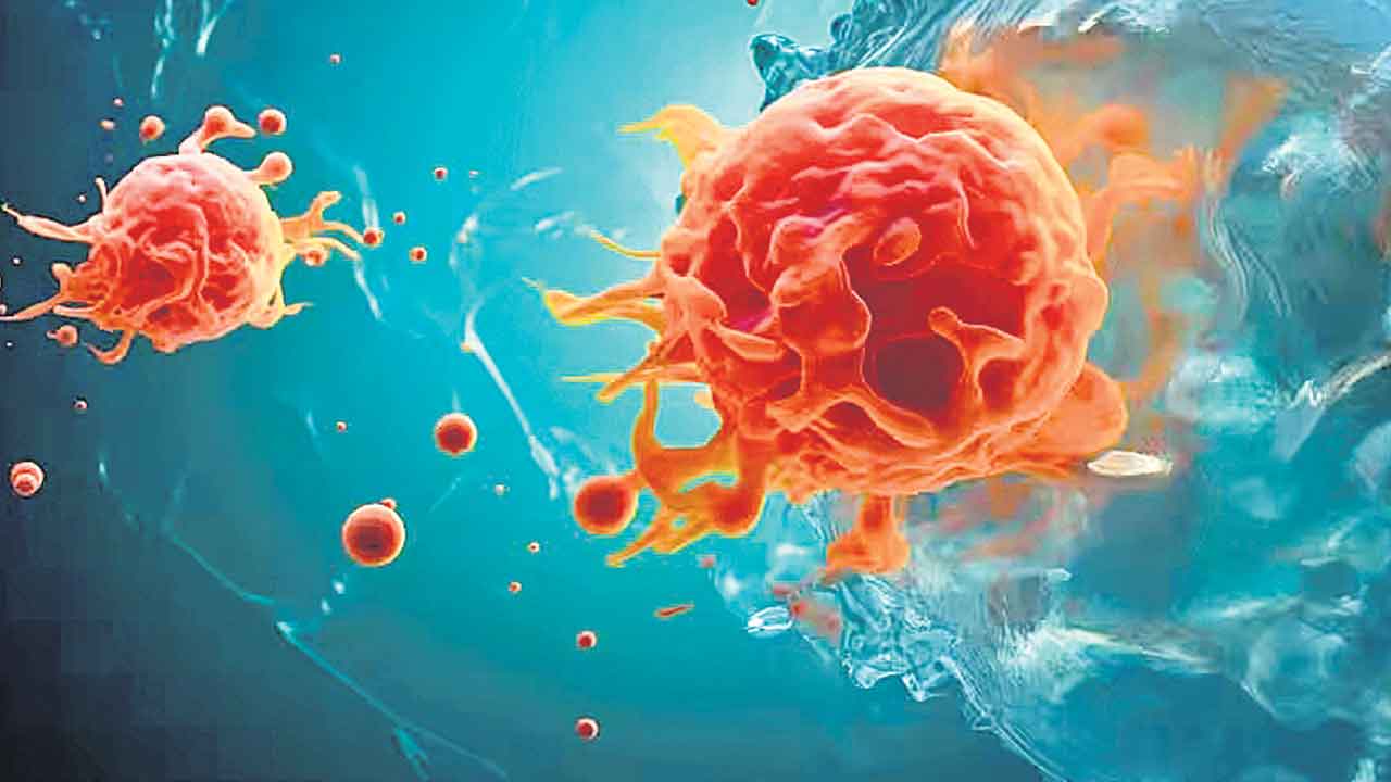 Cancer Cells | అమైనోసియానైన్‌ అణువులతో క్యాన్సర్‌ కణాలు 99% అంతం