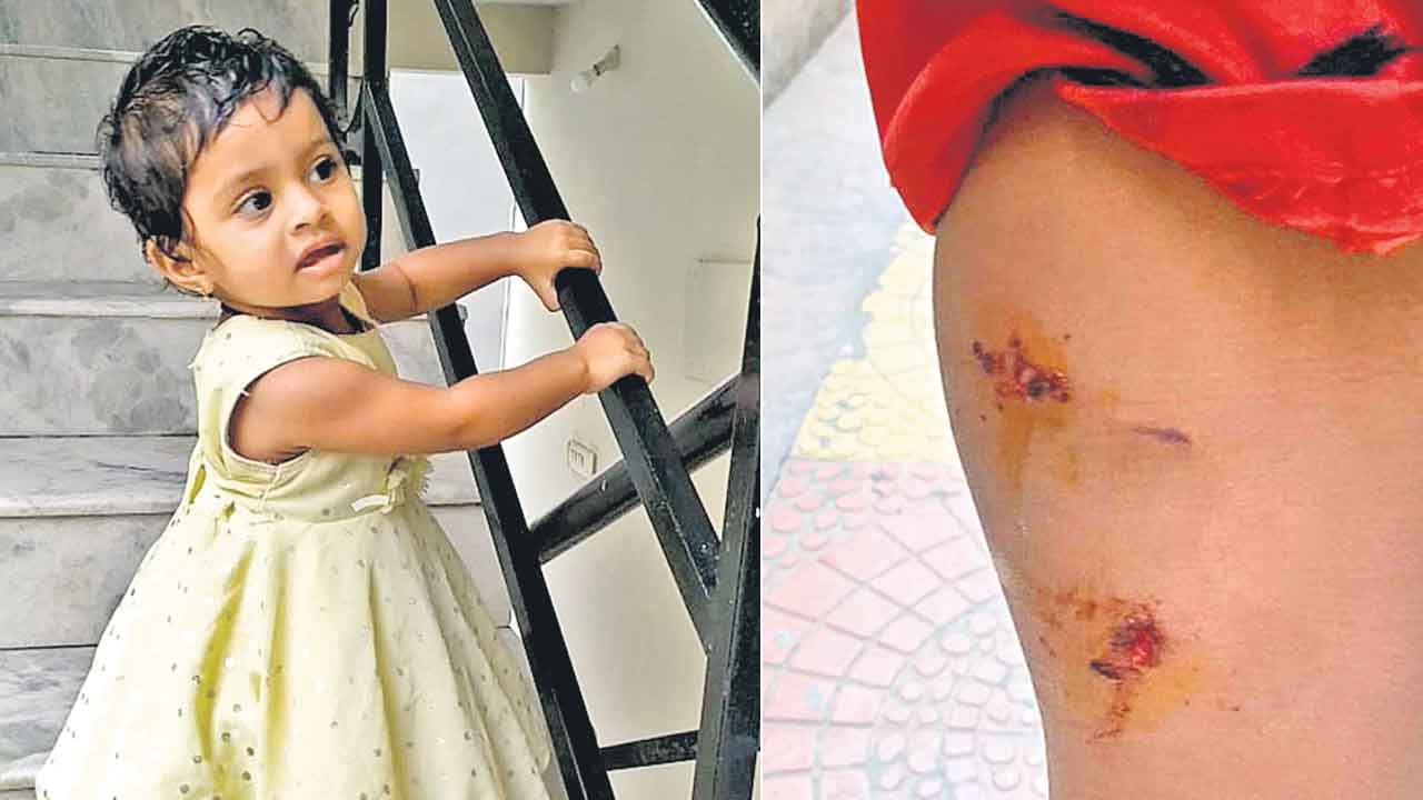 వీధి కుక్కల దాడి